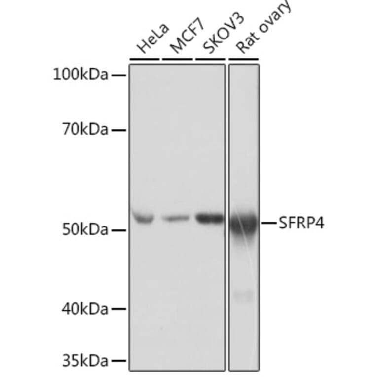 Western Blot - Anti-SFRP4 Antibody [ARC0923] (A305346) - Antibodies.com