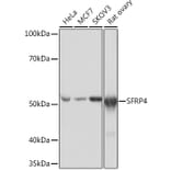 Western Blot - Anti-SFRP4 Antibody [ARC0923] (A305346) - Antibodies.com