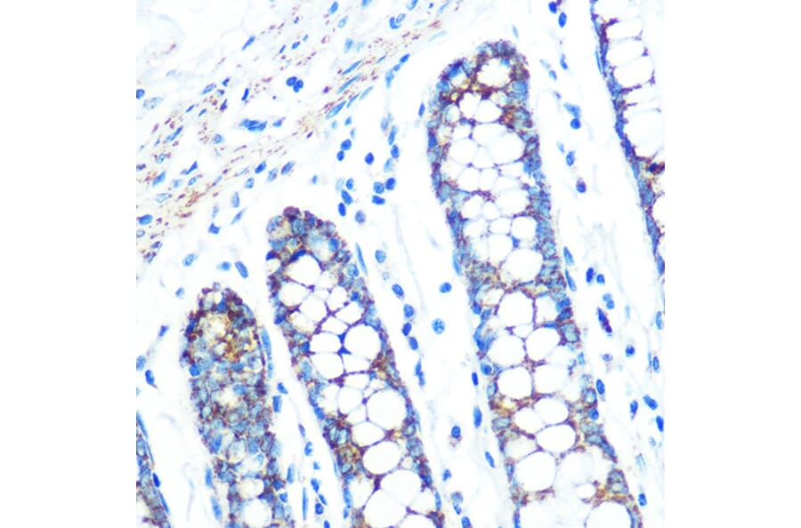 Immunohistochemistry - Anti-SFRP4 Antibody [ARC0923] (A305346) - Antibodies.com