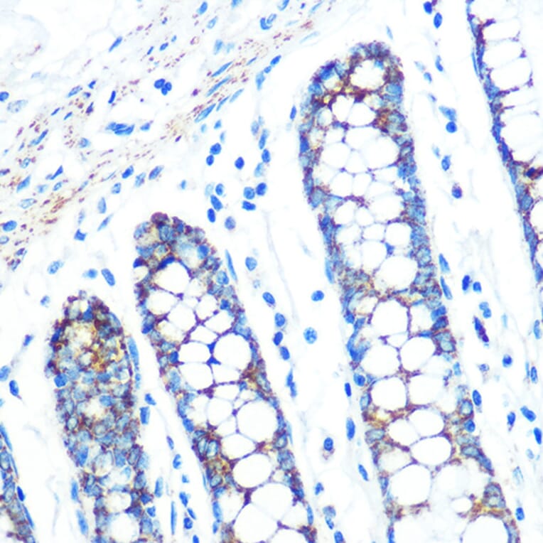 Immunohistochemistry - Anti-SFRP4 Antibody [ARC0923] (A305346) - Antibodies.com