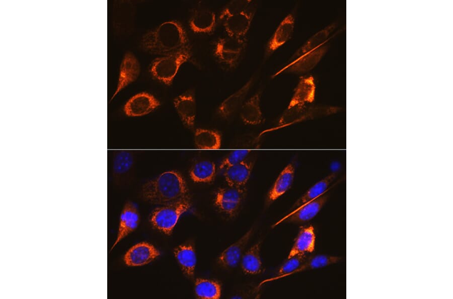 Immunofluorescence - Anti-SFRP4 Antibody [ARC0923] (A305346) - Antibodies.com