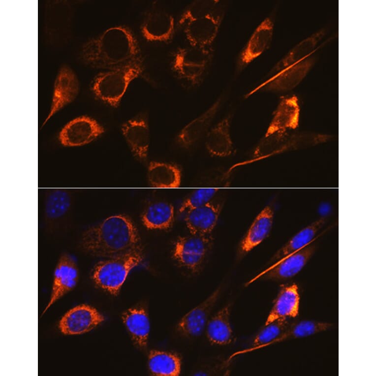 Immunofluorescence - Anti-SFRP4 Antibody [ARC0923] (A305346) - Antibodies.com