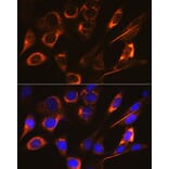 Immunofluorescence - Anti-SFRP4 Antibody [ARC0923] (A305346) - Antibodies.com