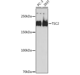 Western Blot - Anti-Tuberin Antibody [ARC0019] (A305347) - Antibodies.com