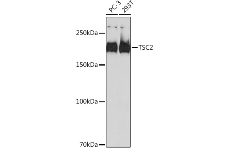 Western Blot - Anti-Tuberin Antibody [ARC0019] (A305347) - Antibodies.com