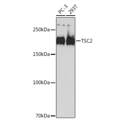 Western Blot - Anti-Tuberin Antibody [ARC0019] (A305347) - Antibodies.com
