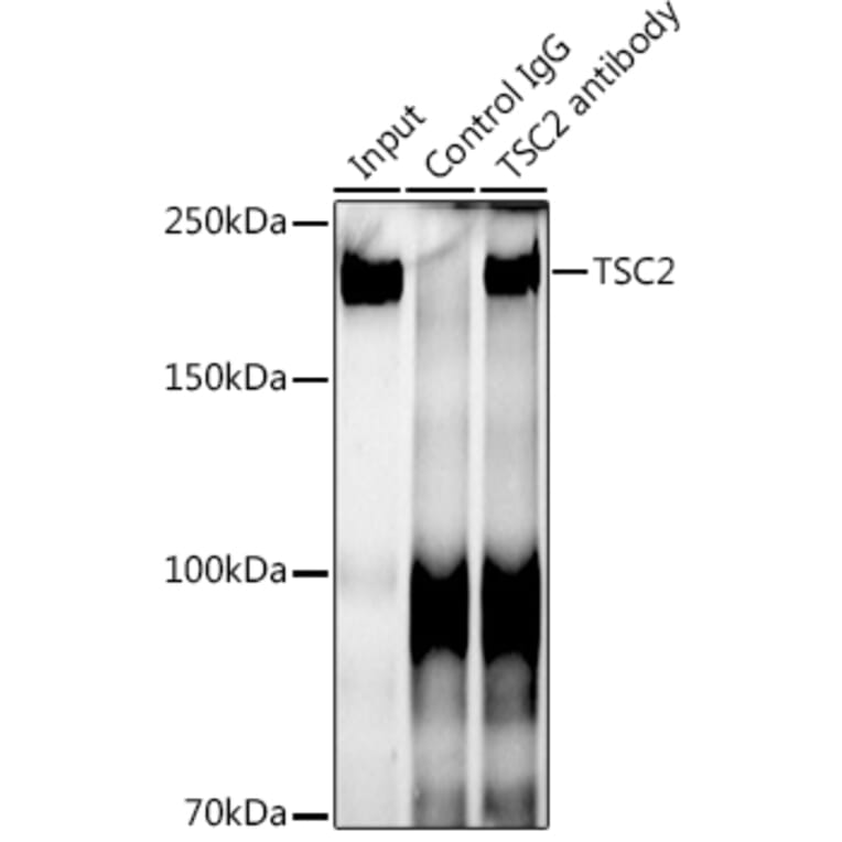 Western Blot - Anti-Tuberin Antibody [ARC0019] (A305347) - Antibodies.com