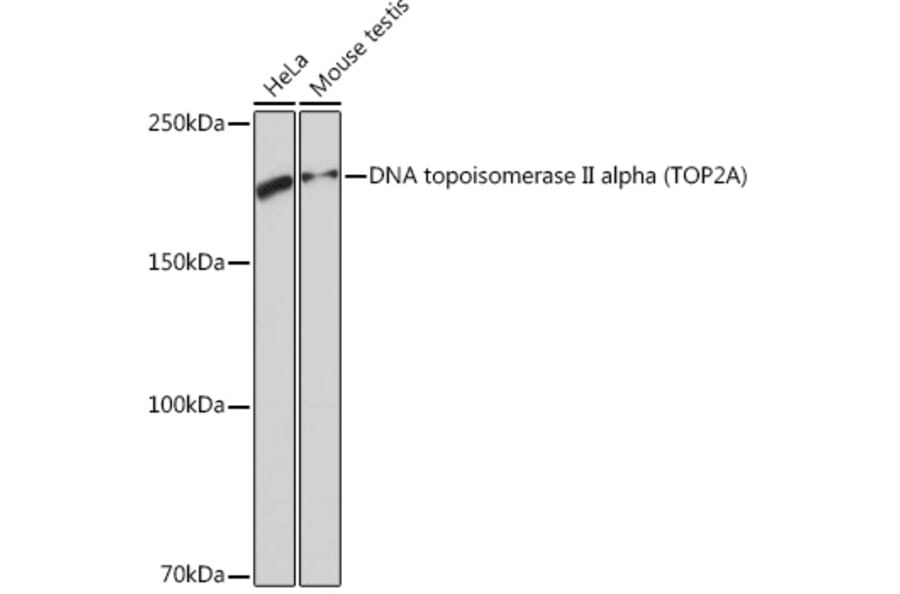 Western Blot - Anti-Topoisomerase II alpha Antibody [ARC0994] (A305348) - Antibodies.com