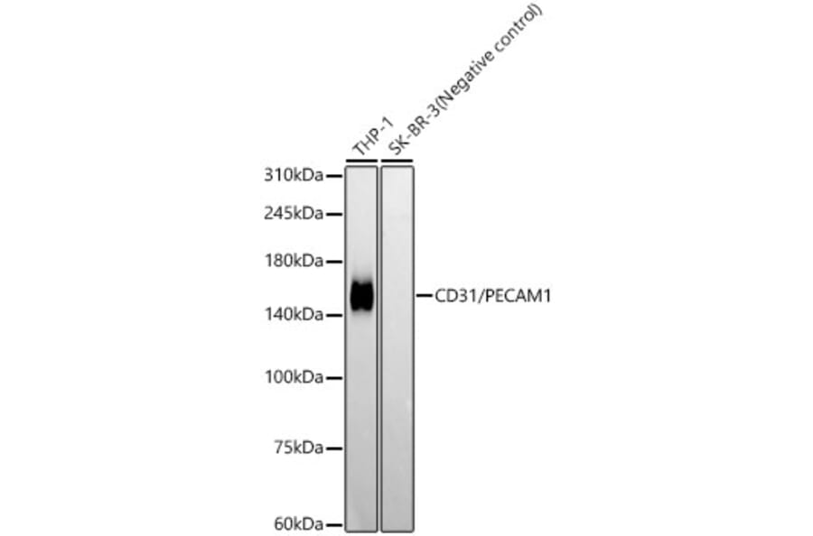 Western Blot - Anti-CD31 Antibody [ARC50362] (A305352) - Antibodies.com
