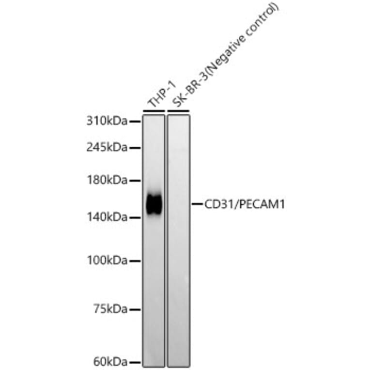 Western Blot - Anti-CD31 Antibody [ARC50362] (A305352) - Antibodies.com