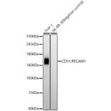 Western Blot - Anti-CD31 Antibody [ARC50362] (A305352) - Antibodies.com