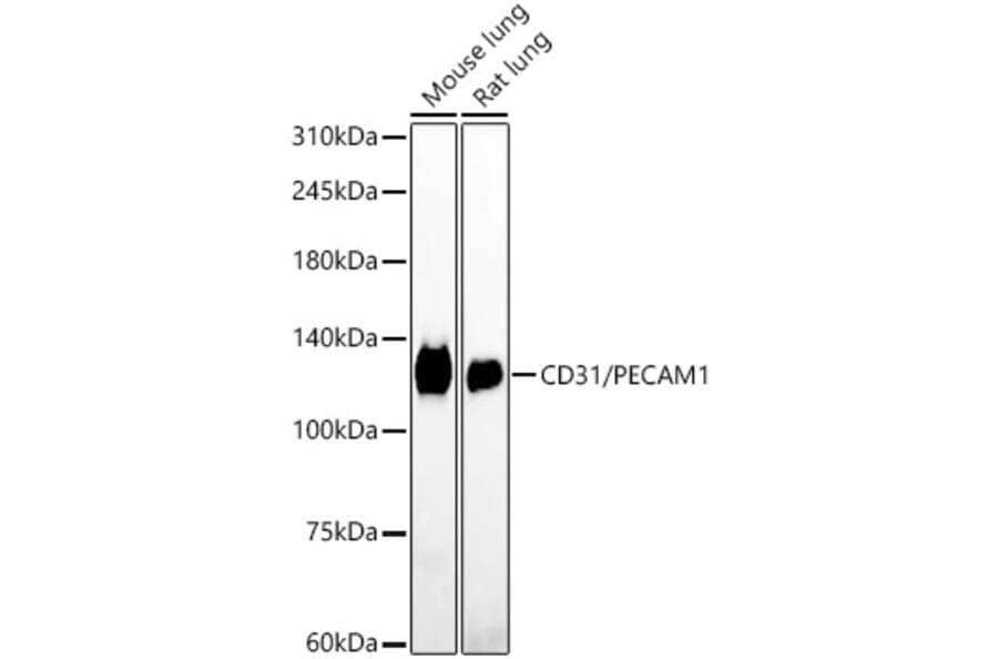 Immunohistochemistry - Anti-CD31 Antibody [ARC50362] (A305352) - Antibodies.com