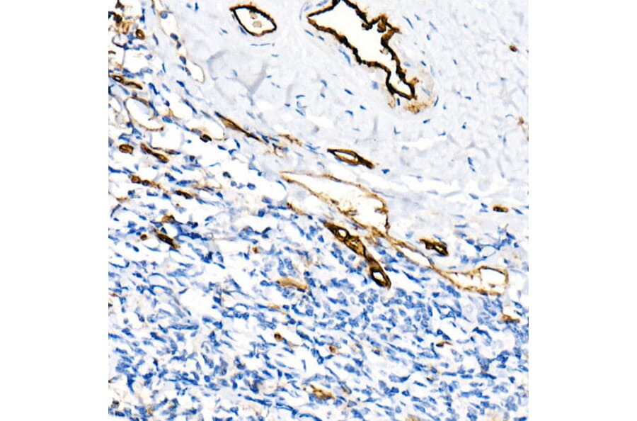 Immunohistochemistry - Anti-CD31 Antibody [ARC50362] (A305352) - Antibodies.com