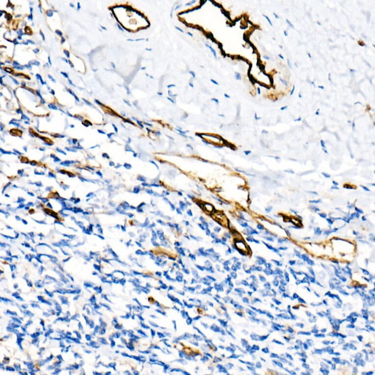 Immunohistochemistry - Anti-CD31 Antibody [ARC50362] (A305352) - Antibodies.com