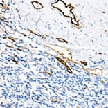 Immunohistochemistry - Anti-CD31 Antibody [ARC50362] (A305352) - Antibodies.com