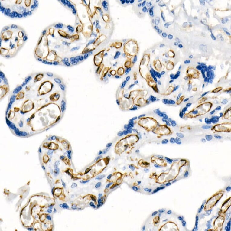 Immunofluorescence - Anti-CD31 Antibody [ARC50362] (A305352) - Antibodies.com