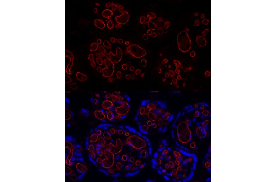 Immunofluorescence - Anti-CD31 Antibody [ARC50362] (A305352) - Antibodies.com