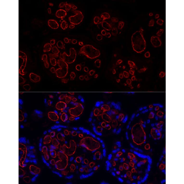 Immunofluorescence - Anti-CD31 Antibody [ARC50362] (A305352) - Antibodies.com