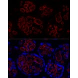Immunofluorescence - Anti-CD31 Antibody [ARC50362] (A305352) - Antibodies.com