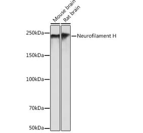Western Blot - Anti-Neurofilament heavy polypeptide Antibody [ARC0494] (A305353) - Antibodies.com