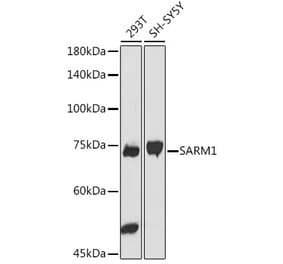 Western Blot - Anti-SARM Antibody (A305354) - Antibodies.com