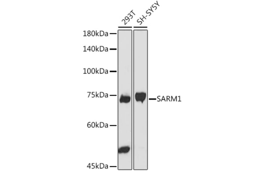 Western Blot - Anti-SARM Antibody (A305354) - Antibodies.com
