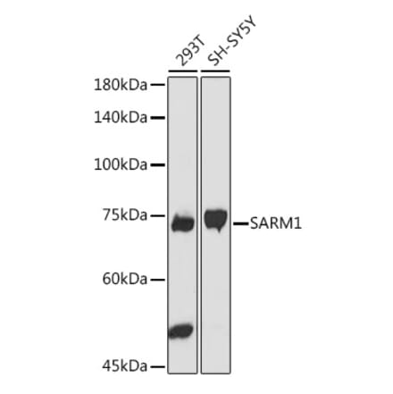 Western Blot - Anti-SARM Antibody (A305354) - Antibodies.com