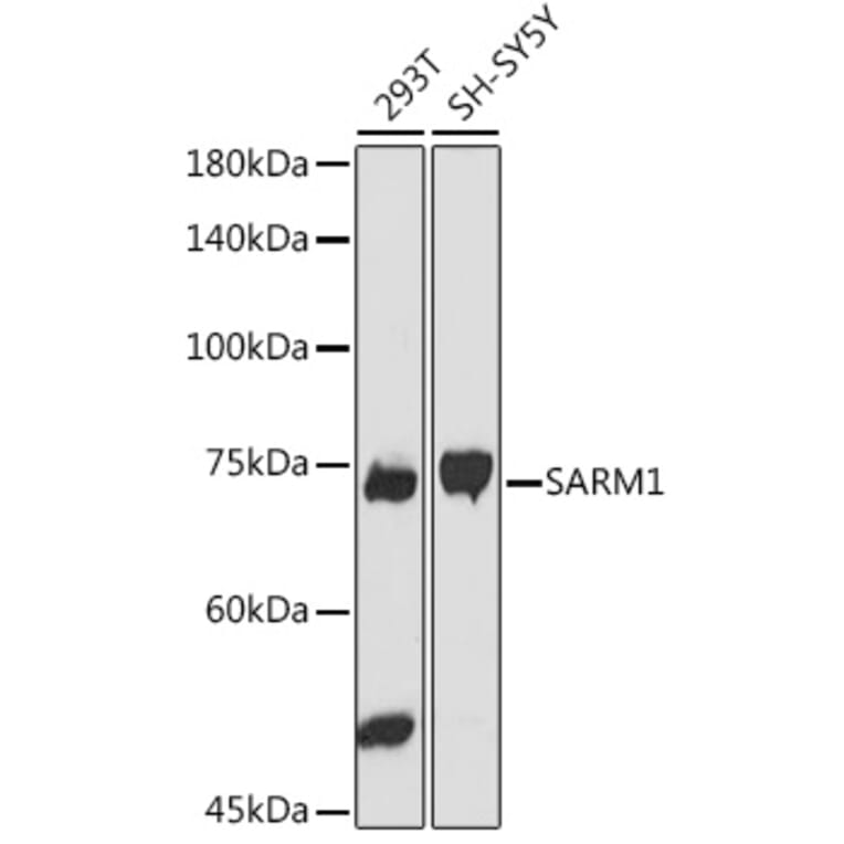 Western Blot - Anti-SARM Antibody (A305354) - Antibodies.com