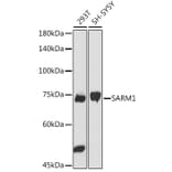 Western Blot - Anti-SARM Antibody (A305354) - Antibodies.com