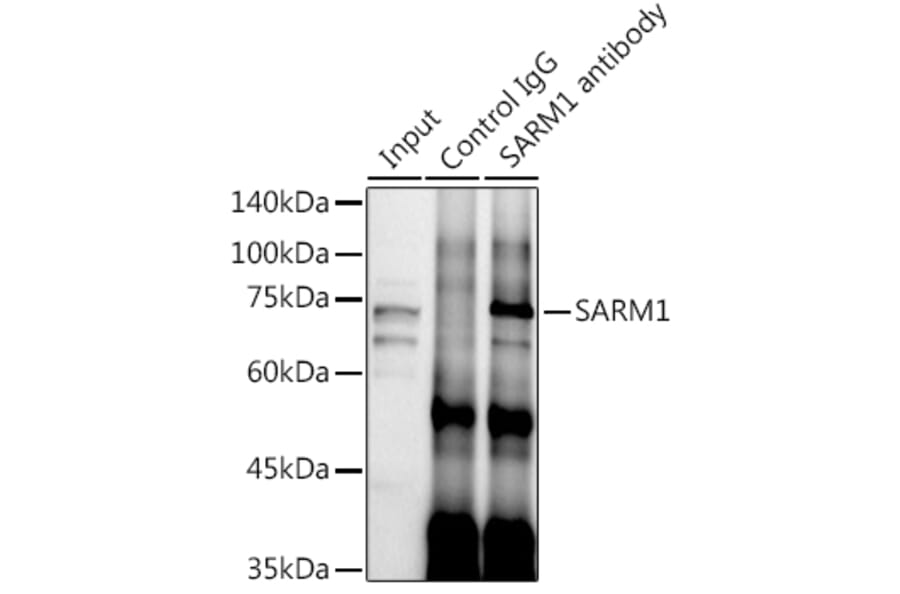 Western Blot - Anti-SARM Antibody (A305354) - Antibodies.com