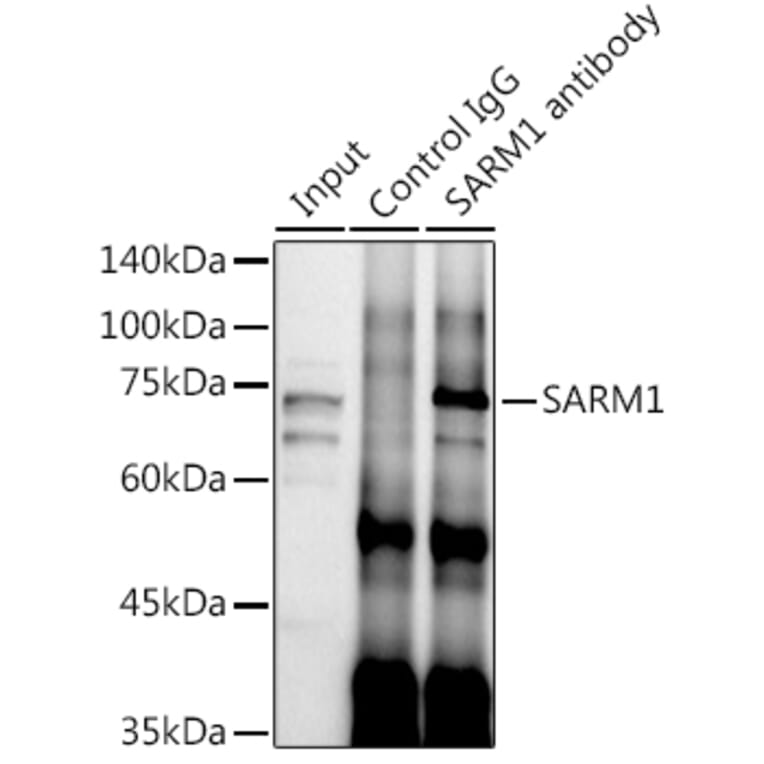 Western Blot - Anti-SARM Antibody (A305354) - Antibodies.com