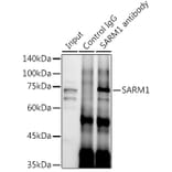 Western Blot - Anti-SARM Antibody (A305354) - Antibodies.com