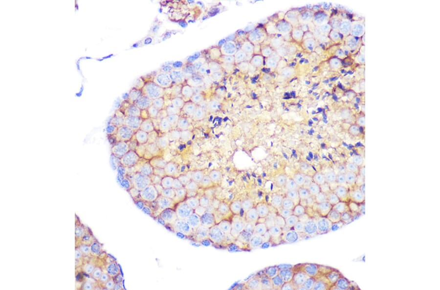 Immunohistochemistry - Anti-Integrin alpha 4/CD49D Antibody [ARC0888] (A305356) - Antibodies.com