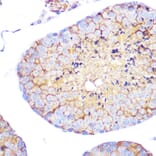 Immunohistochemistry - Anti-Integrin alpha 4/CD49D Antibody [ARC0888] (A305356) - Antibodies.com