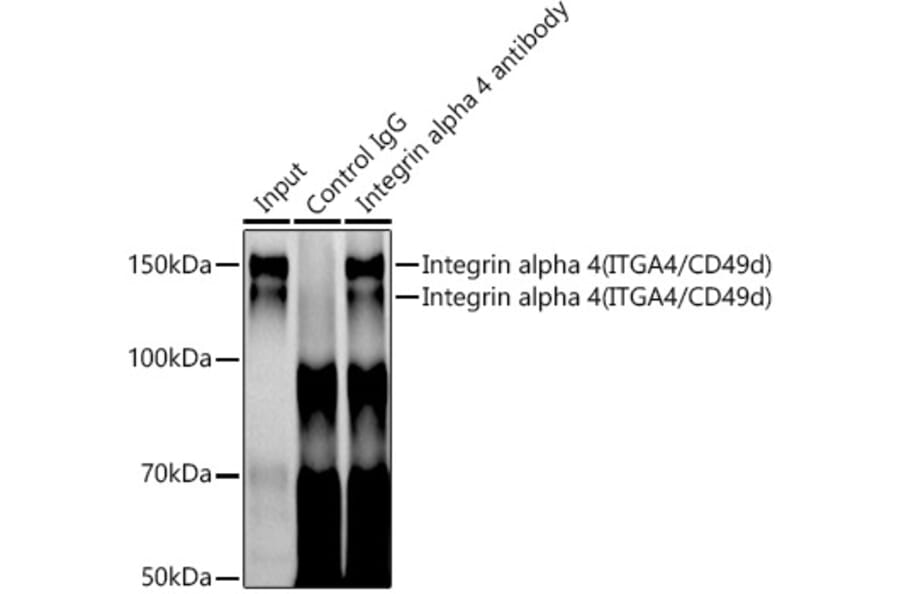 Western Blot - Anti-Integrin alpha 4/CD49D Antibody [ARC0888] (A305356) - Antibodies.com