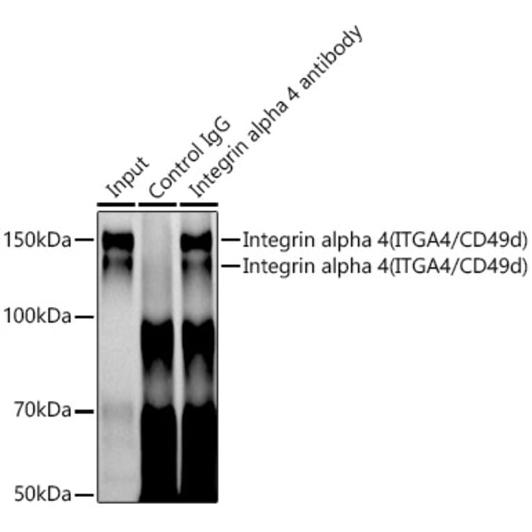 Western Blot - Anti-Integrin alpha 4/CD49D Antibody [ARC0888] (A305356) - Antibodies.com