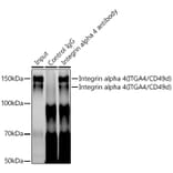 Western Blot - Anti-Integrin alpha 4/CD49D Antibody [ARC0888] (A305356) - Antibodies.com