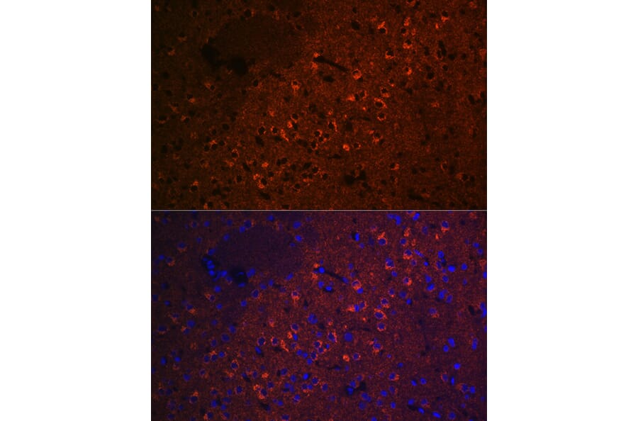 Immunofluorescence - Anti-CEND1 Antibody [ARC2092] (A305358) - Antibodies.com