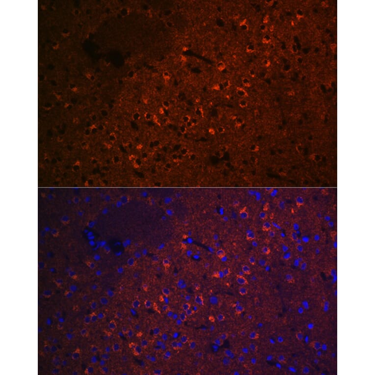 Immunofluorescence - Anti-CEND1 Antibody [ARC2092] (A305358) - Antibodies.com