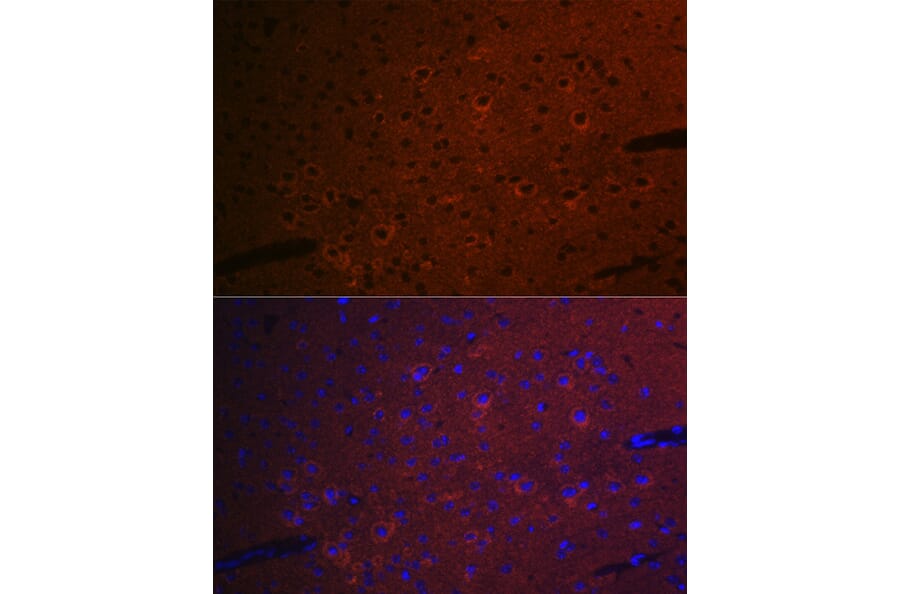 Immunofluorescence - Anti-CEND1 Antibody [ARC2092] (A305358) - Antibodies.com