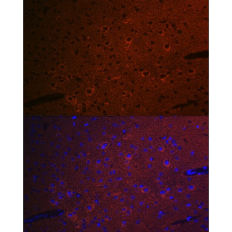 Immunofluorescence - Anti-CEND1 Antibody [ARC2092] (A305358) - Antibodies.com