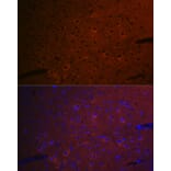 Immunofluorescence - Anti-CEND1 Antibody [ARC2092] (A305358) - Antibodies.com