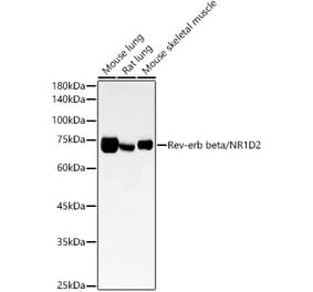 Western Blot - Anti-RVR Antibody [ARC54887] (A305359) - Antibodies.com