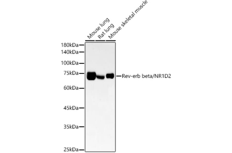 Western Blot - Anti-RVR Antibody [ARC54887] (A305359) - Antibodies.com