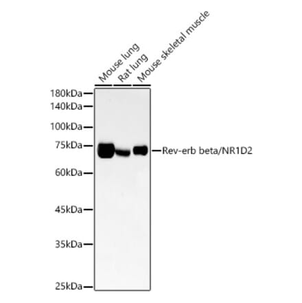 Western Blot - Anti-RVR Antibody [ARC54887] (A305359) - Antibodies.com