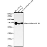 Western Blot - Anti-RVR Antibody [ARC54887] (A305359) - Antibodies.com