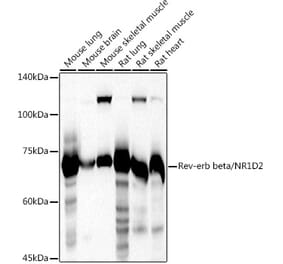 Western Blot - Anti-RVR Antibody (A305360) - Antibodies.com