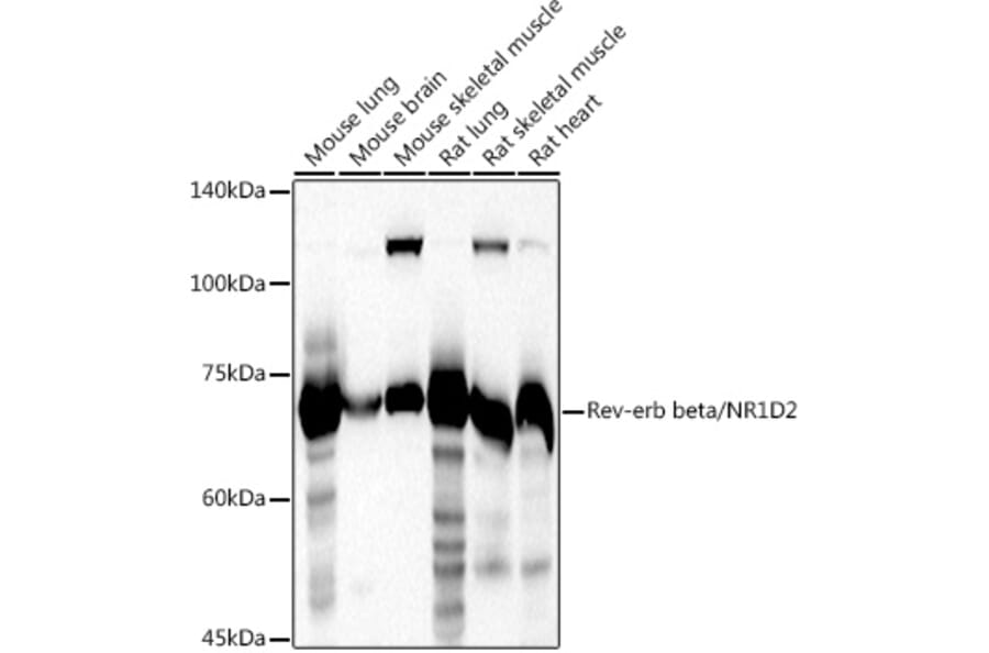 Western Blot - Anti-RVR Antibody (A305360) - Antibodies.com