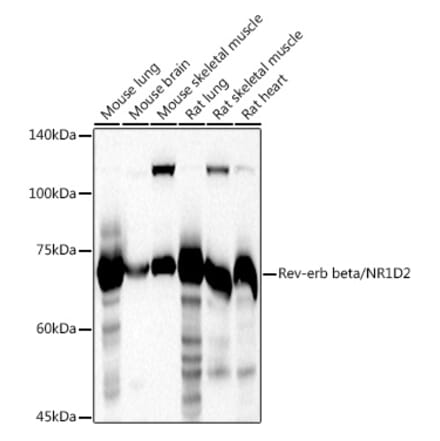Western Blot - Anti-RVR Antibody (A305360) - Antibodies.com