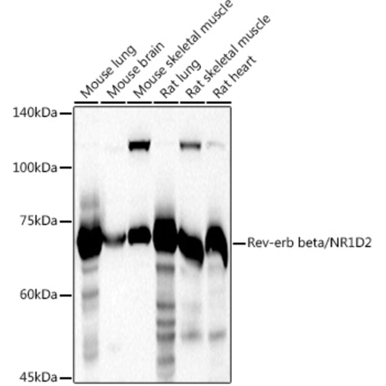 Western Blot - Anti-RVR Antibody (A305360) - Antibodies.com